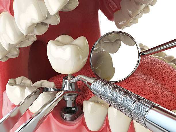 Best Emergency Dental Surgery in Rockville, MD